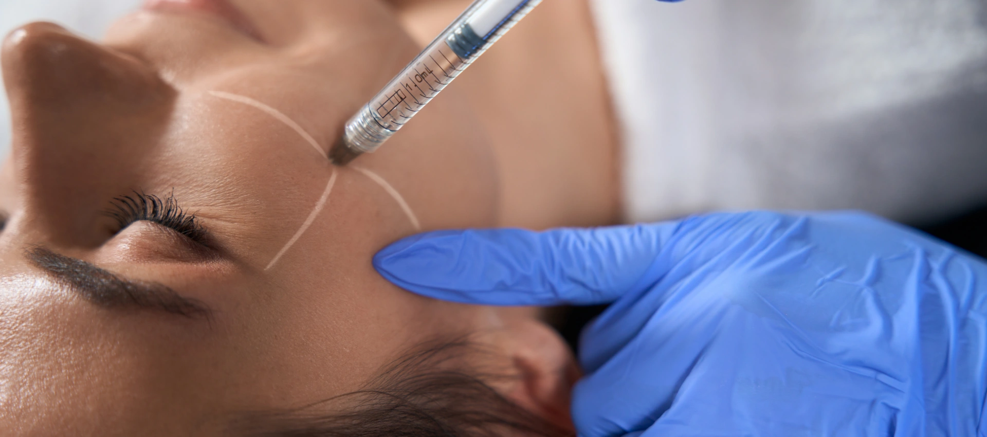 Unlocking the Power of Botox: A Comprehensive Guide by our Office