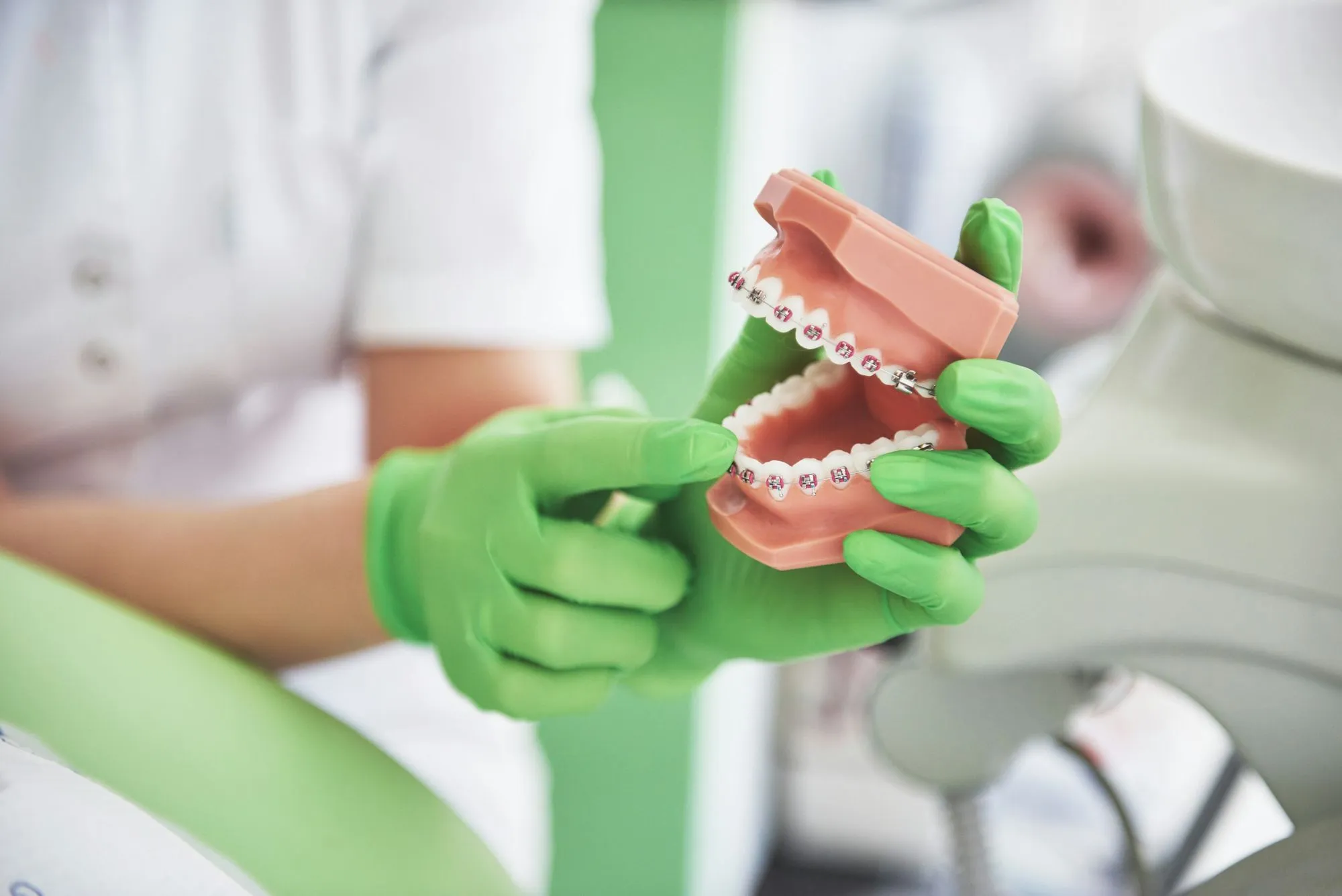 The Ultimate Guide to Braces: Transforming Smiles with Precision and Care