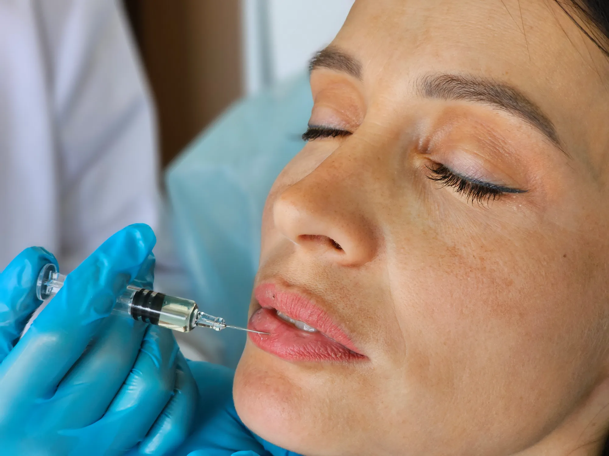 Enhancing Your Smile and Facial Aesthetics with Dermal Fillers: A Comprehensive Guide