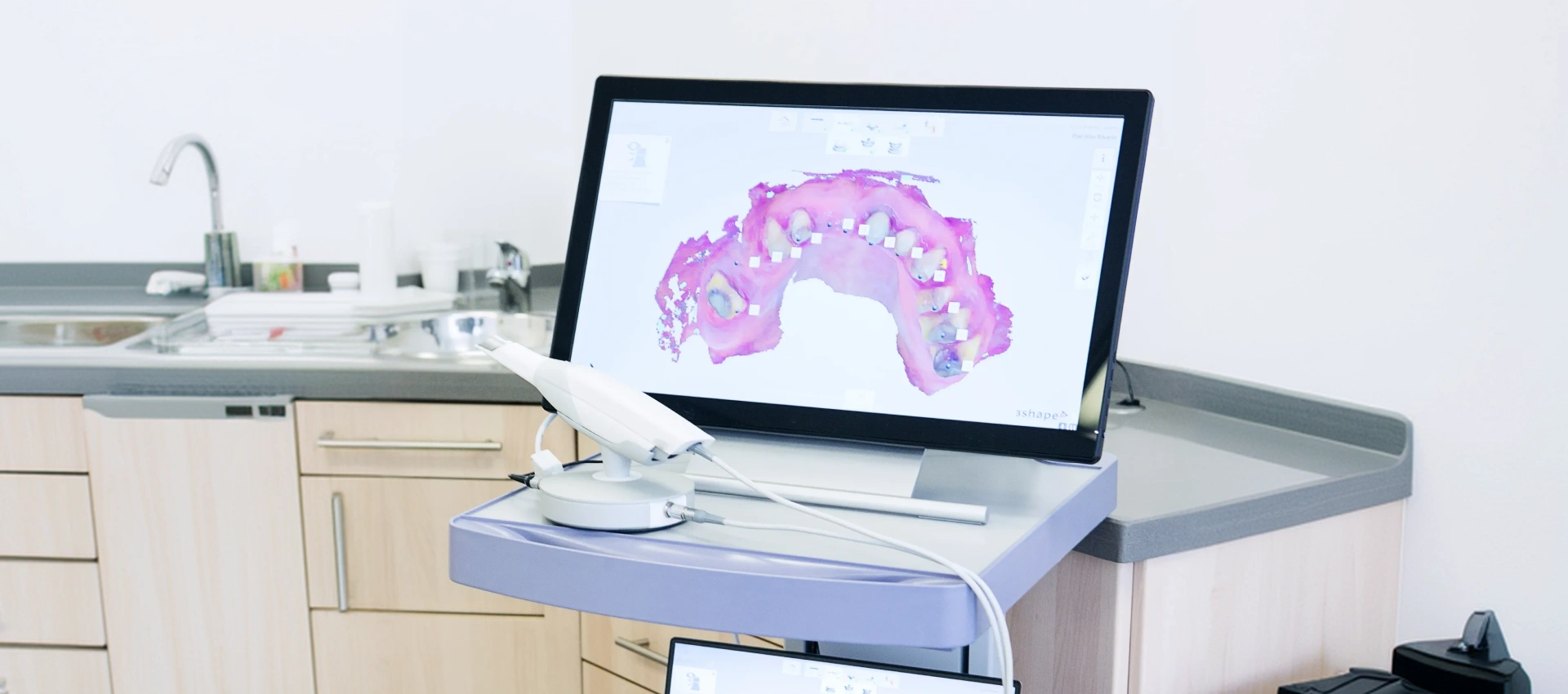 Digital Impression Scanners