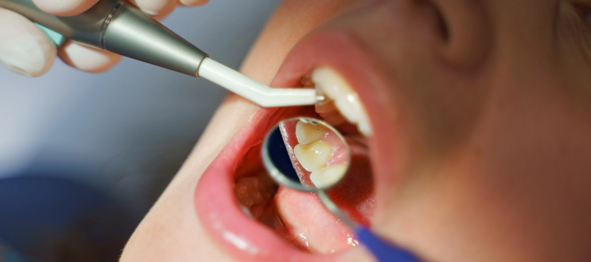 Fluorescent Oral Cancer Screening or Other Screening Devices