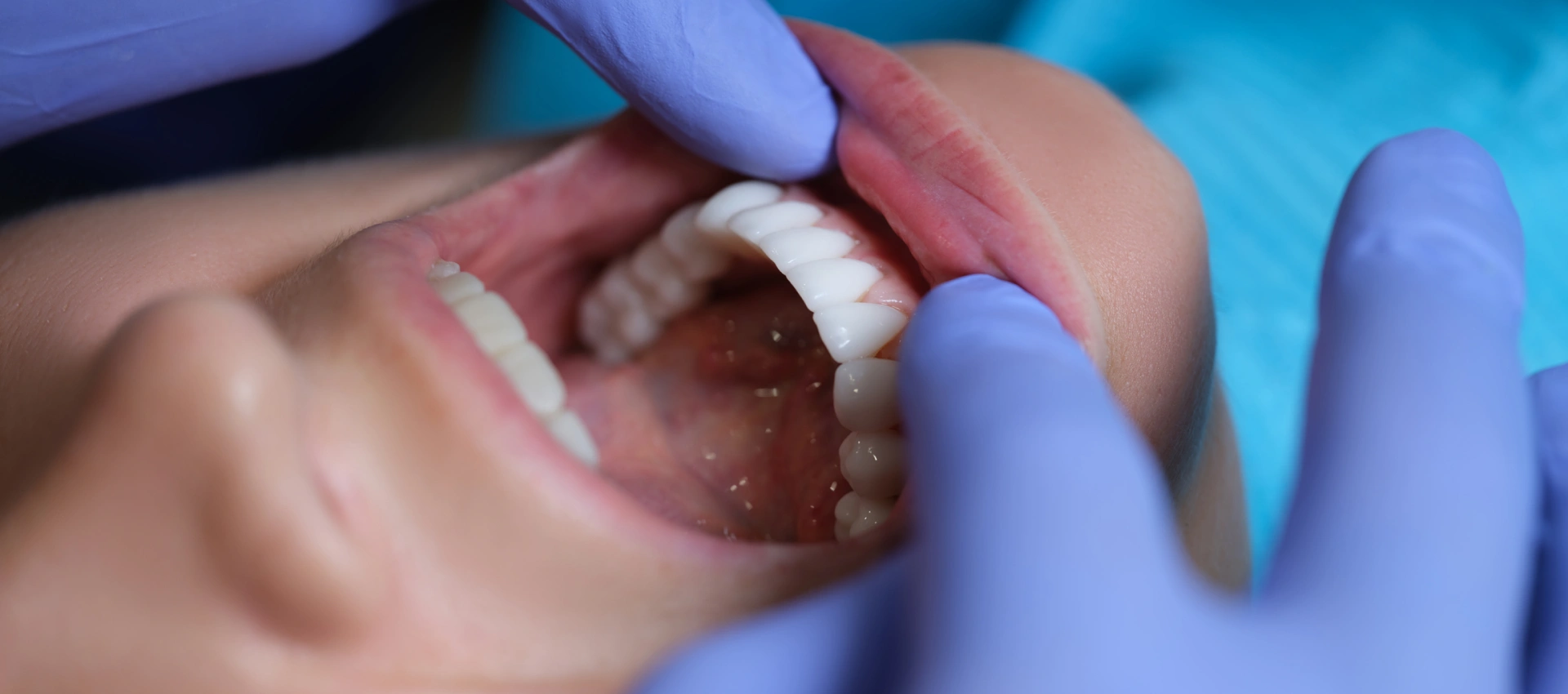 Jaw Measurement Devices