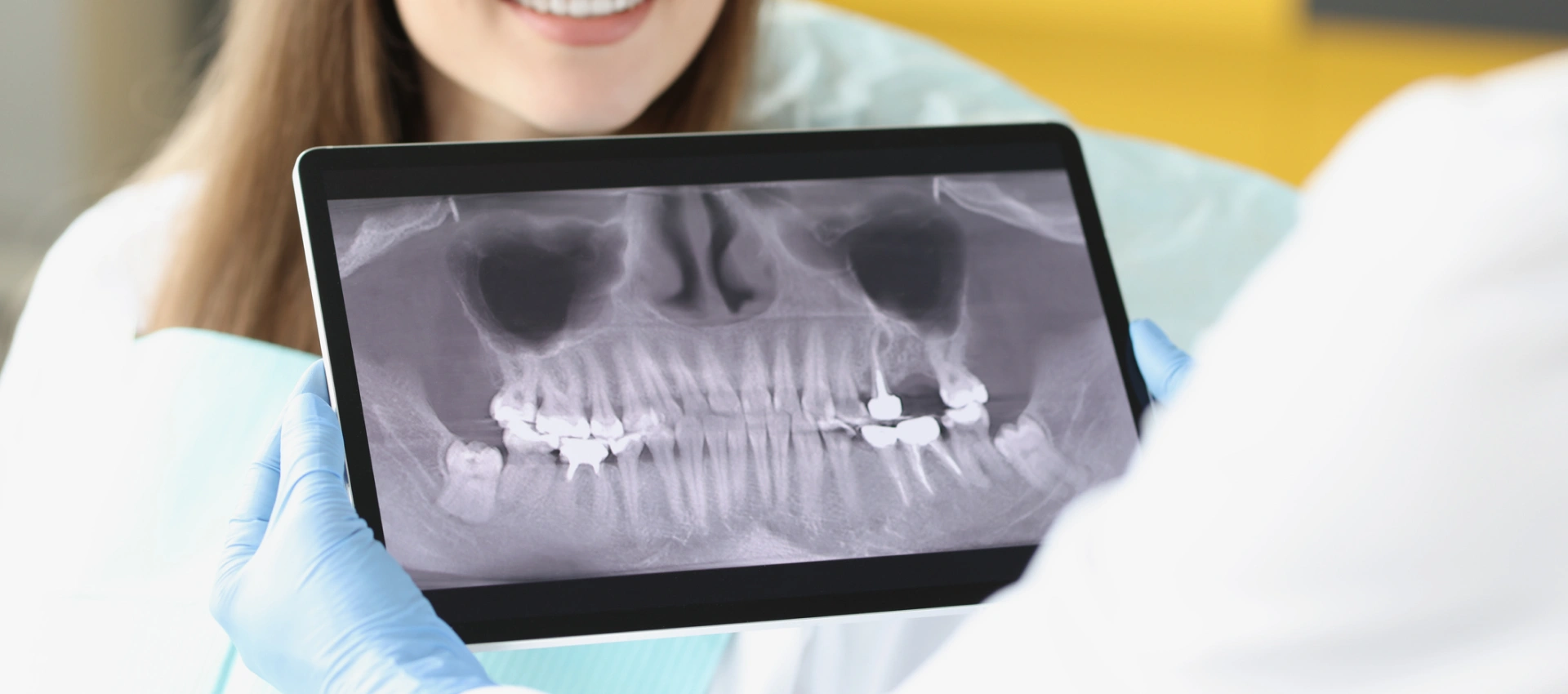 Pearl & Overjet AI Software for X-Ray Analysis