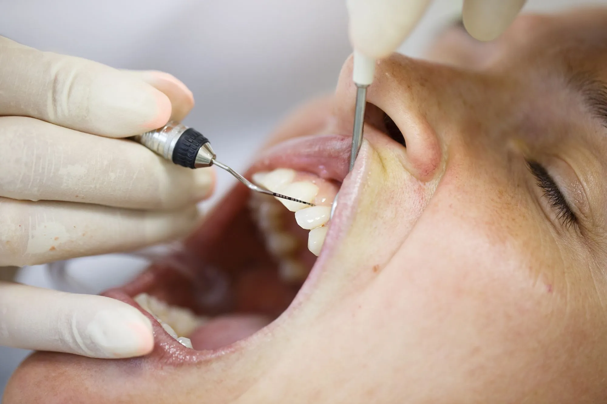 Understanding Periodontal Treatments: Safeguarding Your Smile and Overall Health