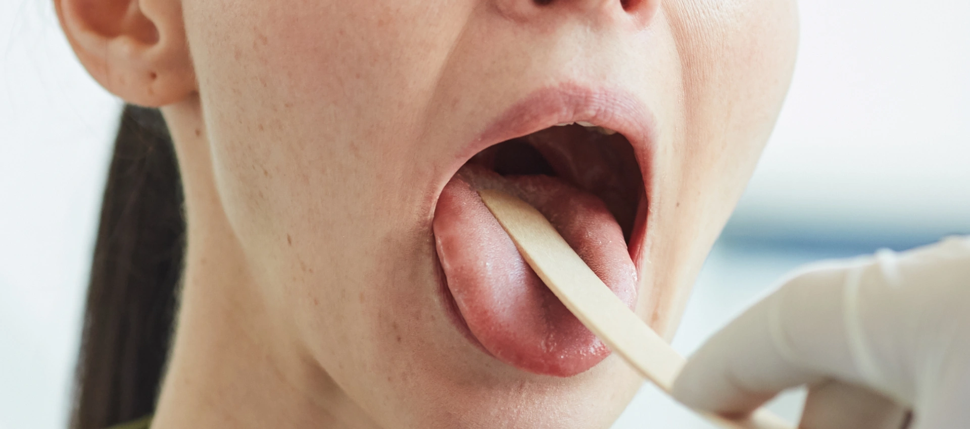 Tongue Depressors