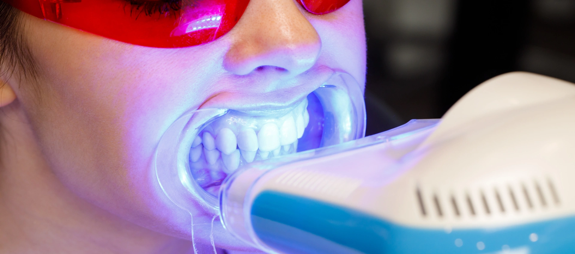 Whitening